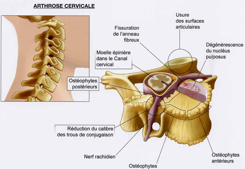 Dolore di vita e tailbone a inclinazioni