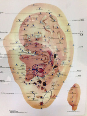 mappa auricoloterapia
